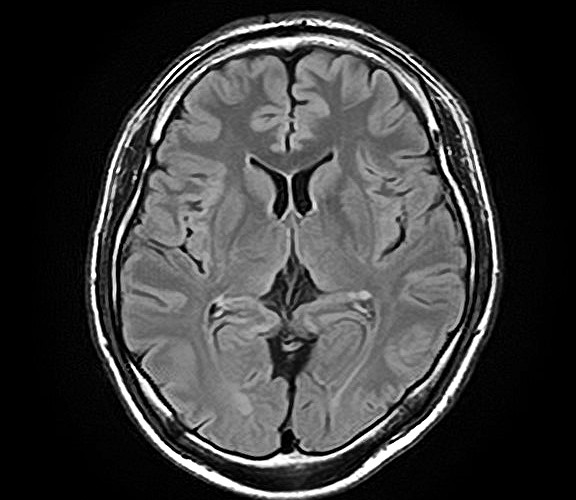 脳MRI・MRA診断画像1