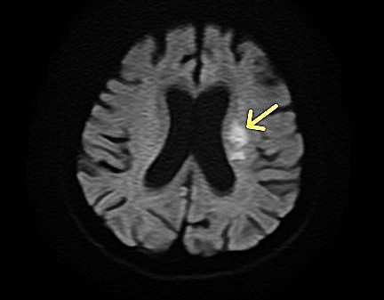脳MRI・MRA診断画像3