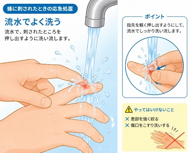 蜂刺され　対処